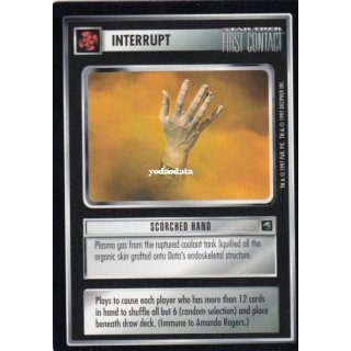 092 Scorched Hand